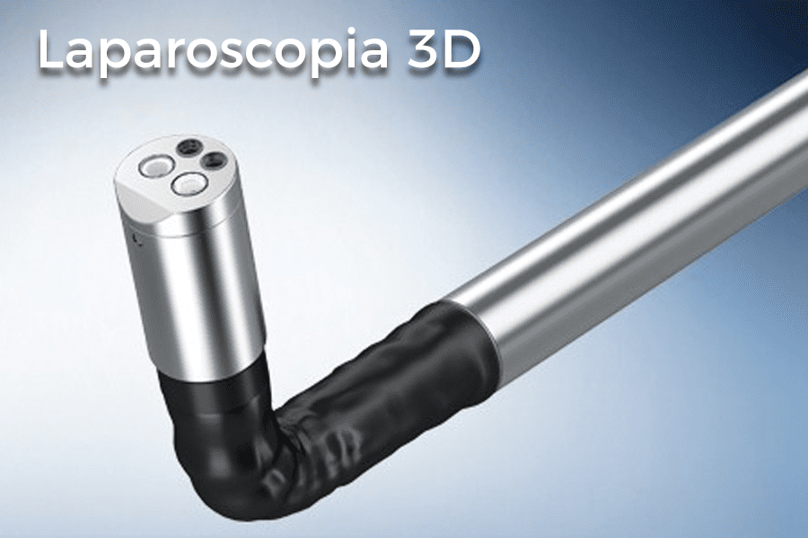 Laparoscopia 3D di ultima generazione