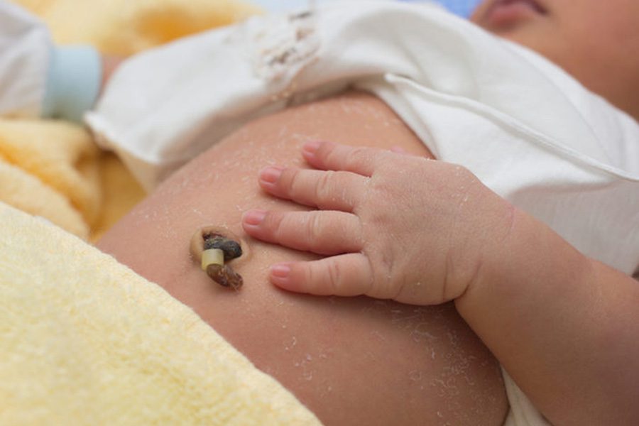 Donazione del sangue da cordone ombelicale